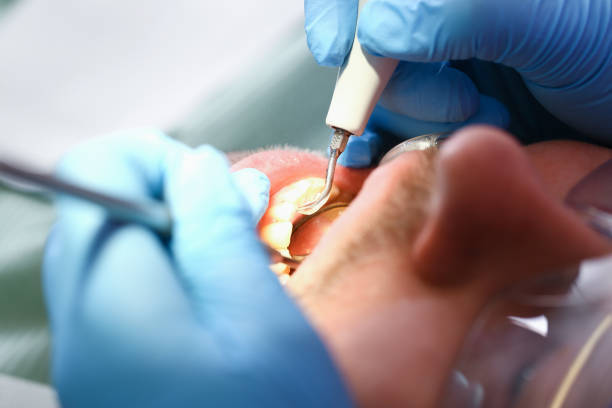 Best Emergency Dental Extractions in Tchula, MS
